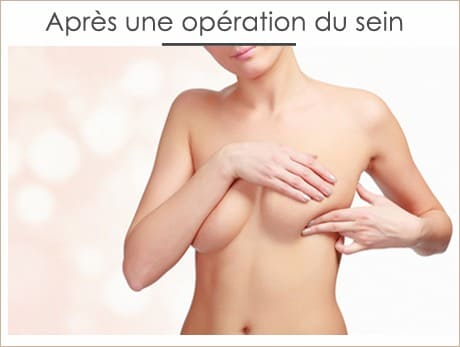 Nos conseils après une opération du sein Nos conseils après une opération du sein